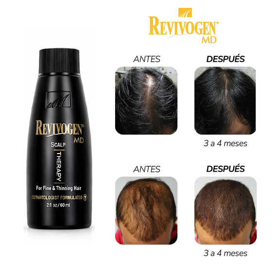 Loción capilar que ayuda a fortalecer y prevenir la caída del cabello - Revivogen Md Kit Therapy
